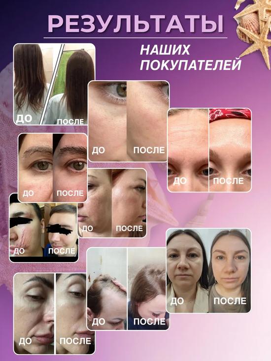 Морской коллаген для суставов